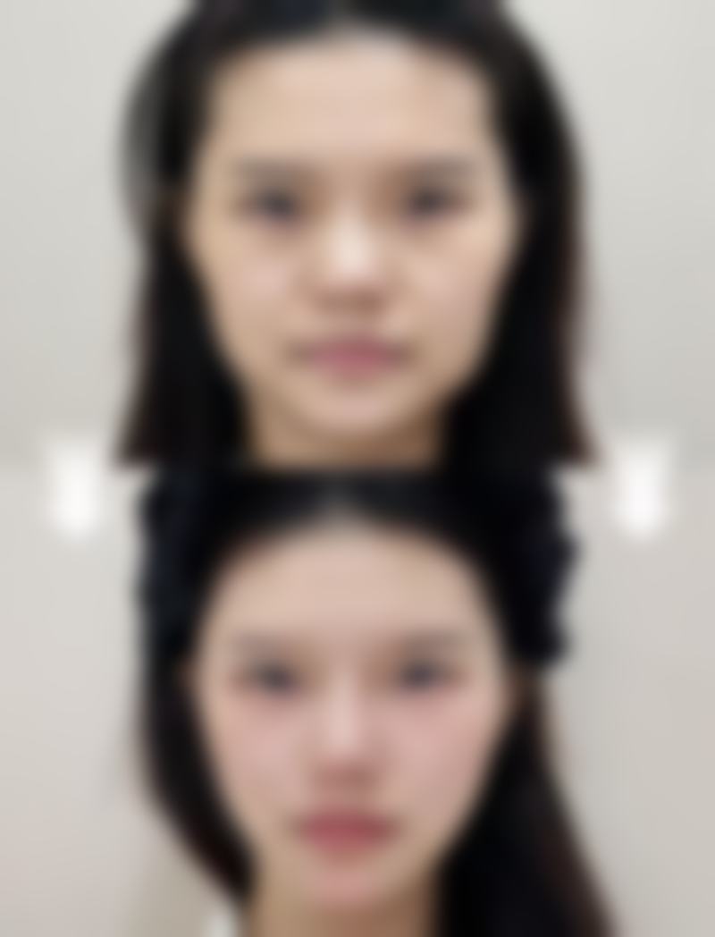 深圳美颜医疗整形美容门诊部怎么样价格收费