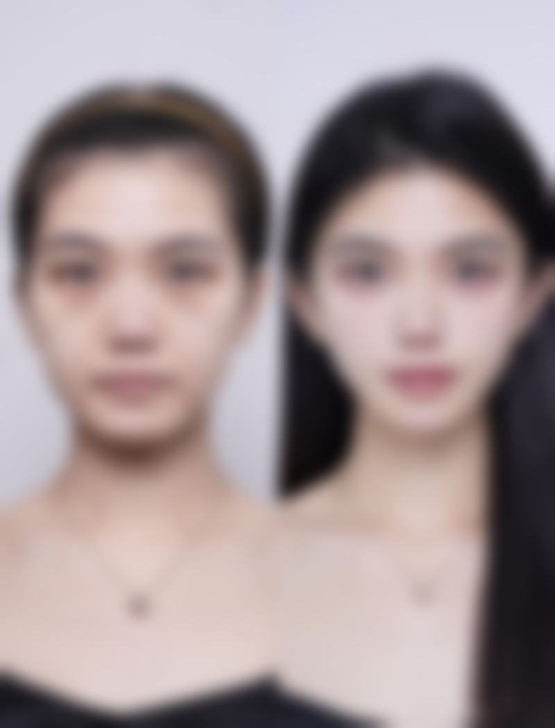 红河哈尼族彝族自治州蒙自白天鹅医疗美容门诊部怎么样来院路线