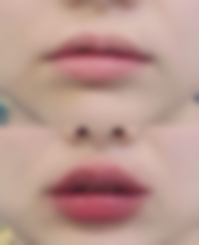 刘余宏医生擅长的美容领域