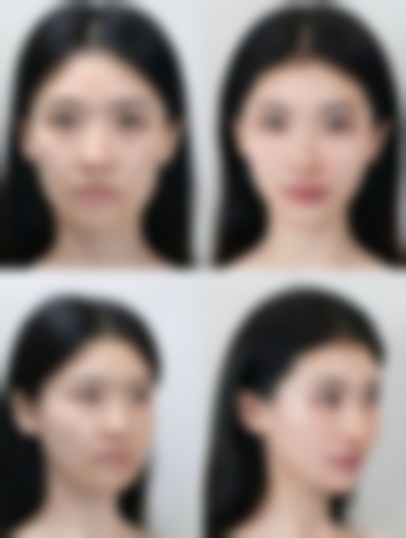 红河哈尼族彝族自治州蒙自白天鹅医疗美容门诊部怎么样医生团队实力