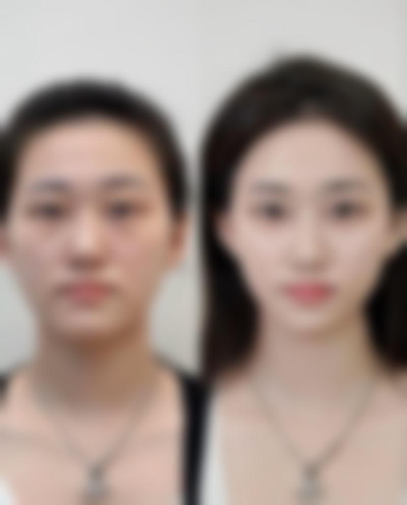 白城于晶医疗美容门诊怎么样求美者反馈