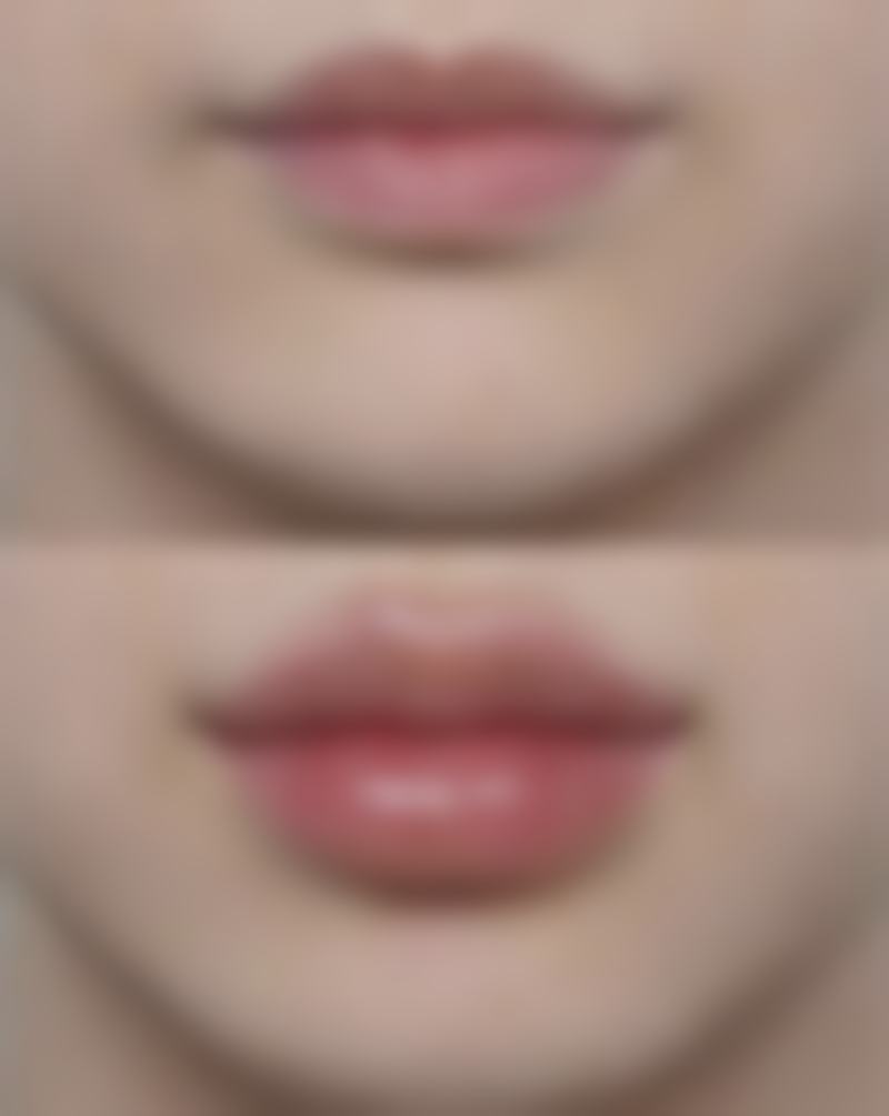 红河哈尼族彝族自治州蒙自白天鹅医疗美容门诊部怎么样特色项目及技术优势