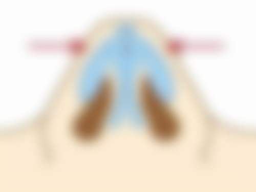 徐勇军 医生注重患者体验