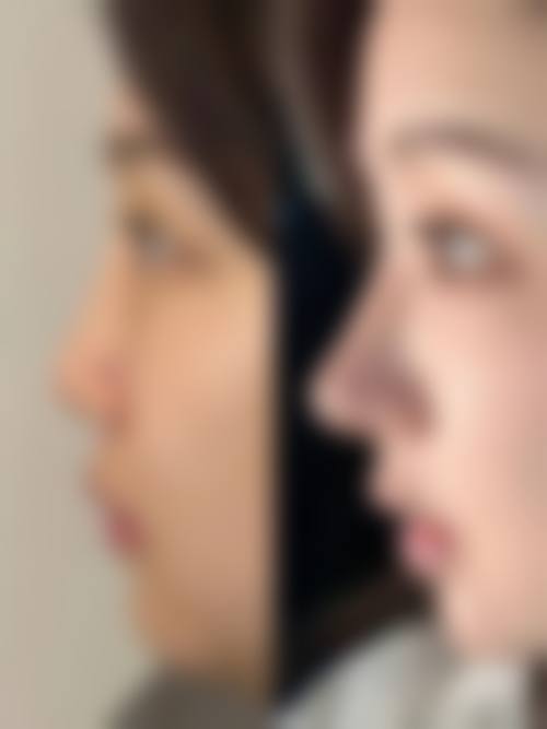 黎秀医生的技术优势