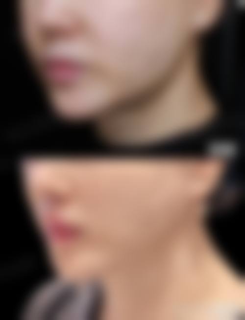 汉中人民医院整形显微外科怎么样特色项目及技术优势