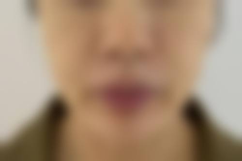 杨顺新医生的贴心服务