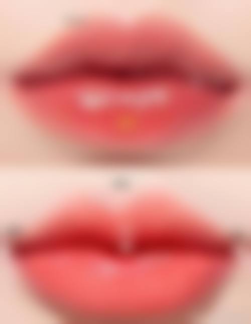 广州真颜整形医院怎么样求美者反馈