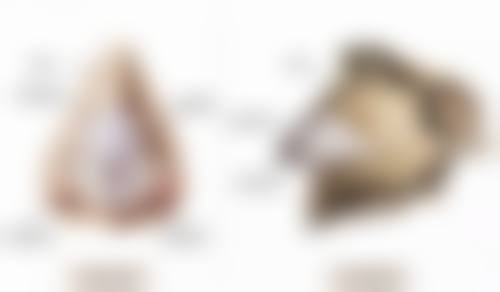 武汉妍妍子新至美整形医院怎么样价格收费