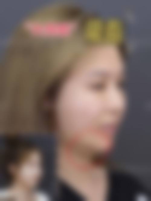 长春长青丽人医疗美容门诊部求美者反馈