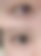 汉中人民医院整形显微外科怎么样来院路线