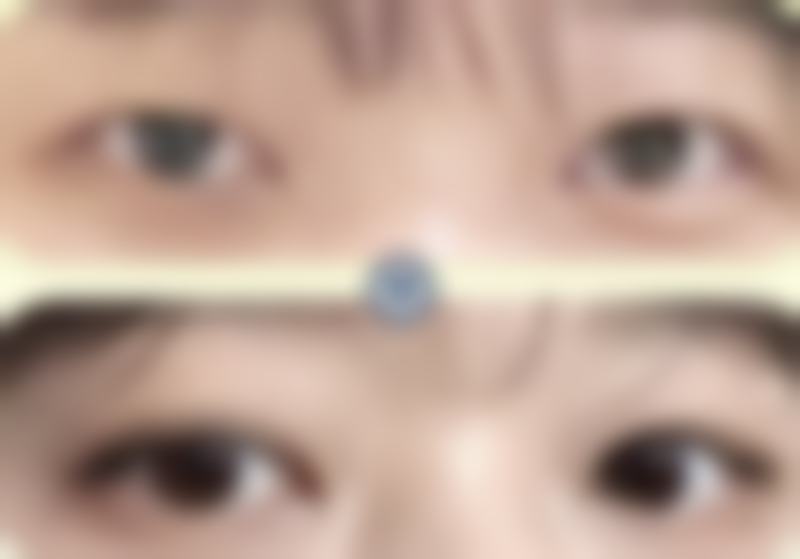 李在承所在医院:韩国INFINI整形外科