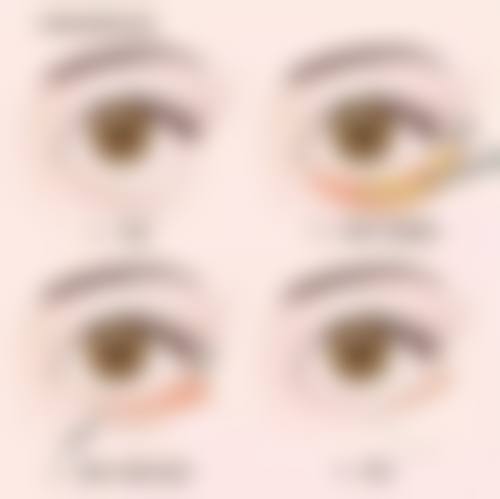 韩国清潭ES整形外科怎么样特色项目及技术优势