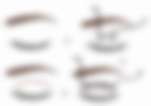 金允熙医生的手术特色