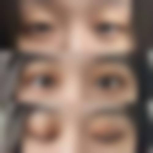 北京叶子医疗美容医院价格收费