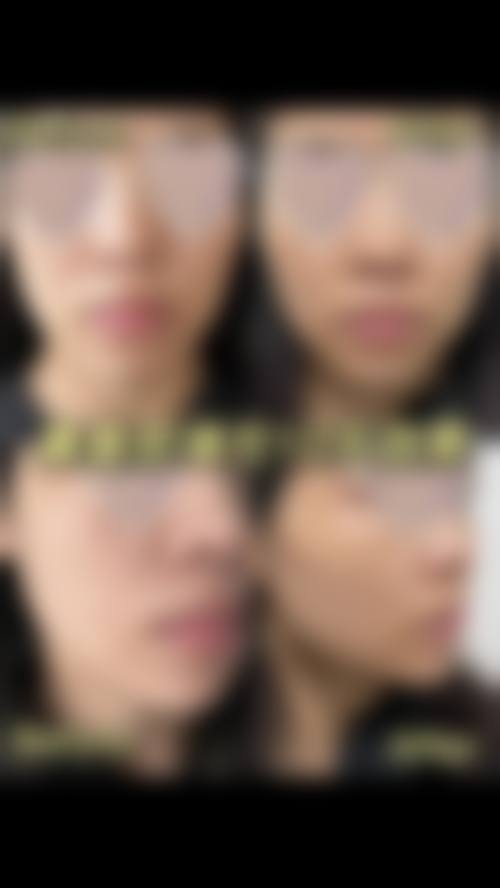 韩国PetitParty整形医院来院路线