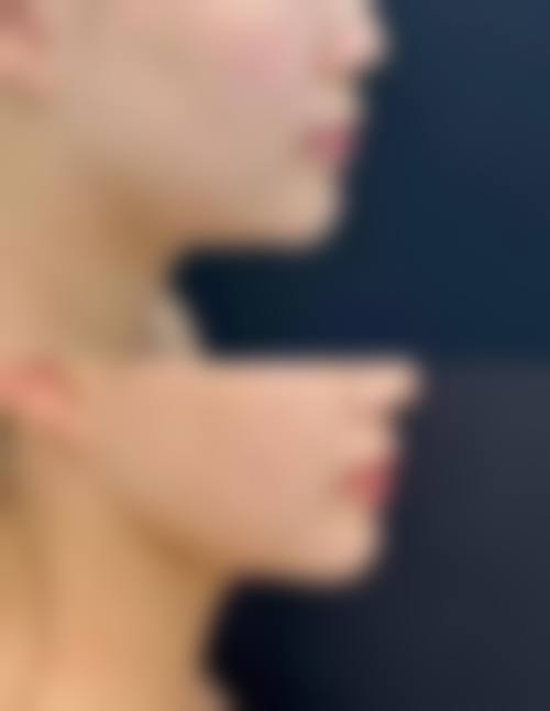 金玹秀院长所在的韩国INFINI整形外科