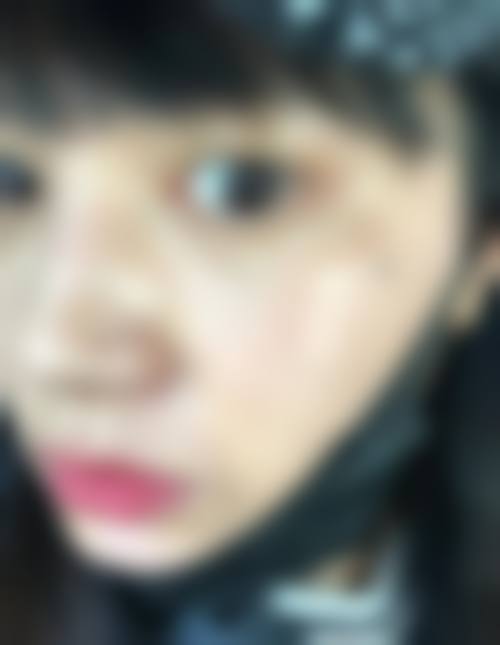 西安倷瑞儿整形医院价格收费