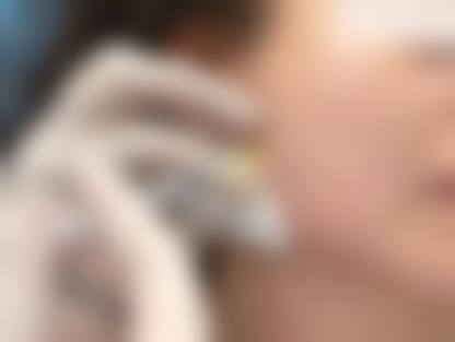 江西省广济激光美容医院怎么样特色项目及技术优势