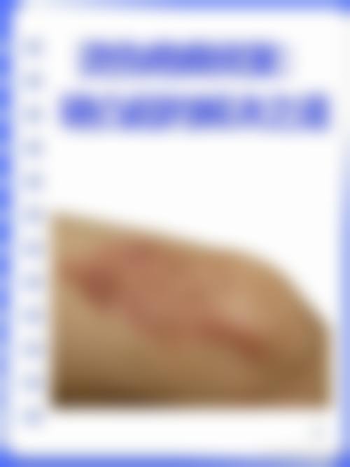 衡阳肤康皮肤病医院怎么样价格收费