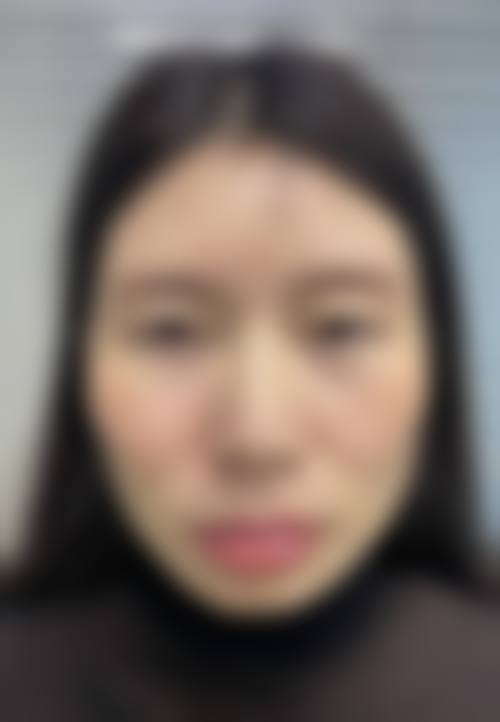 深圳兰乔医疗美容怎么样求美者反馈