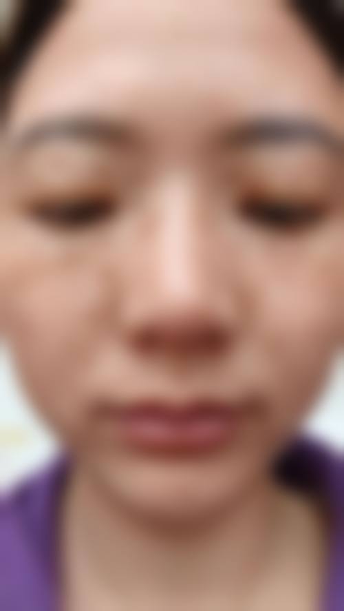 姚容医生助力您绽放美丽