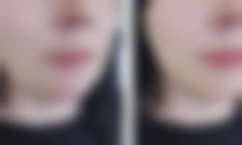 刘宏医生的技术优势