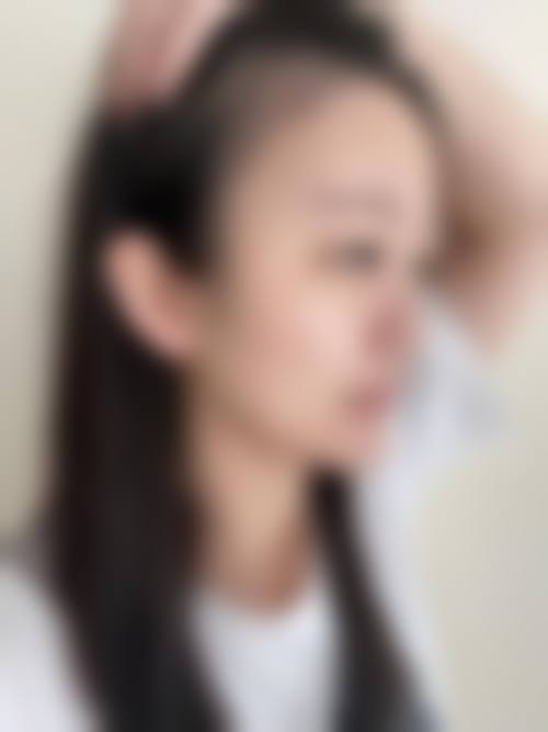 三明艾芙医疗美容诊所价格收费