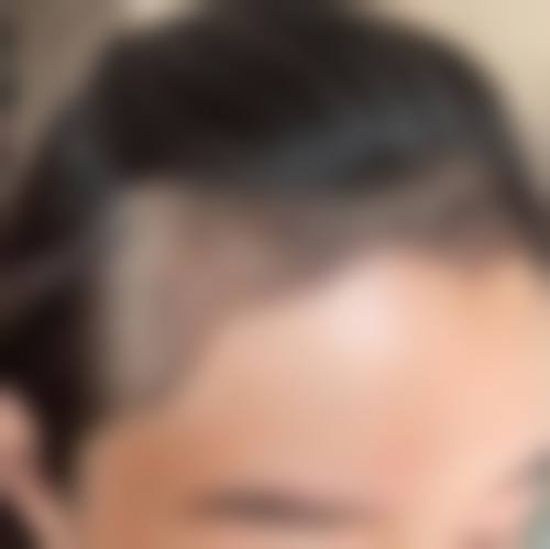 三明艾芙医疗美容诊所特色项目及技术优势