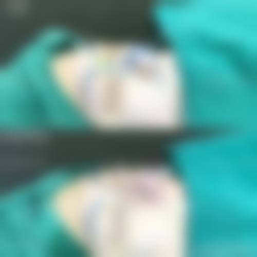 权伍仲：丰富临床经验铸就高成功几率