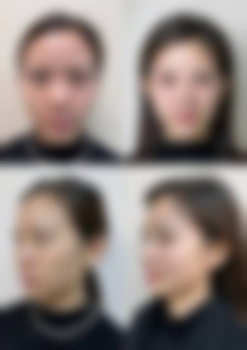 韩国清潭ES整形外科怎么样医生团队实力