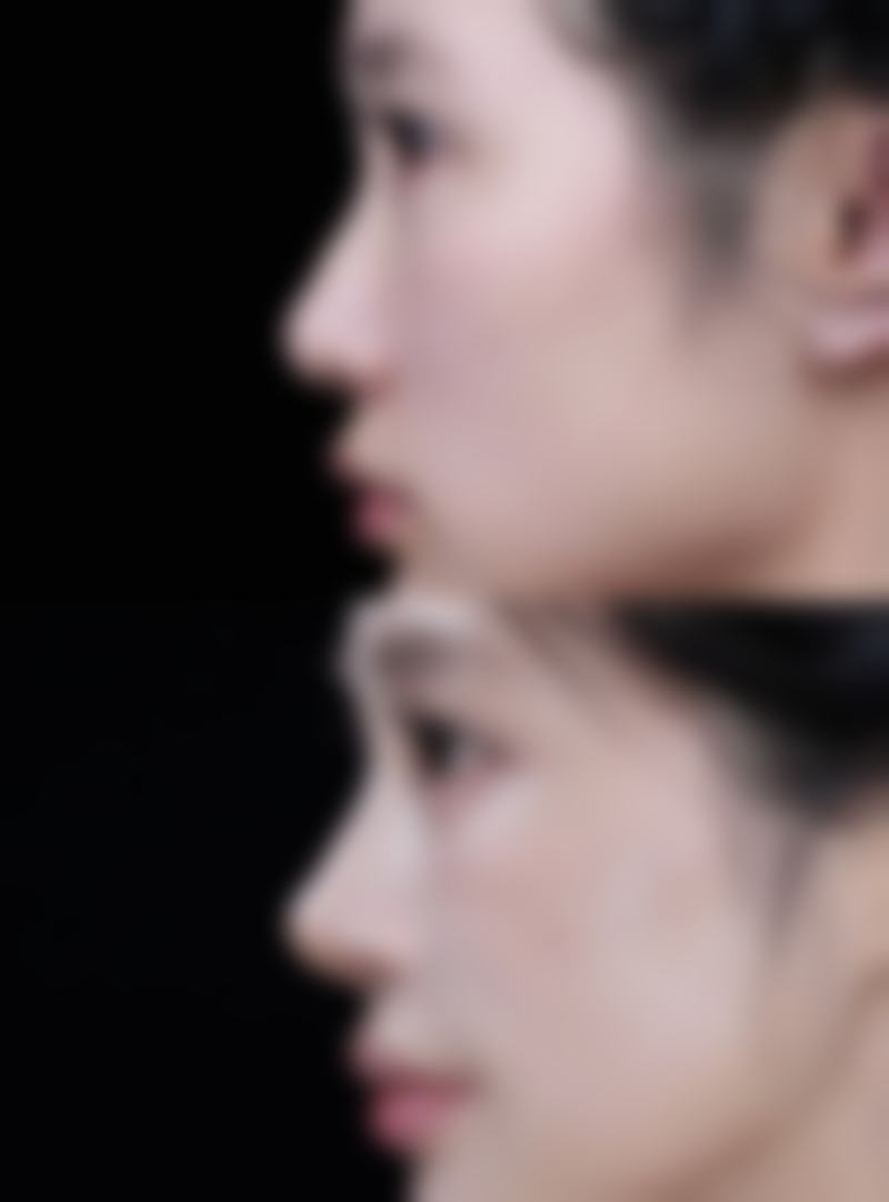 韩国PetitParty整形医院求美者反馈