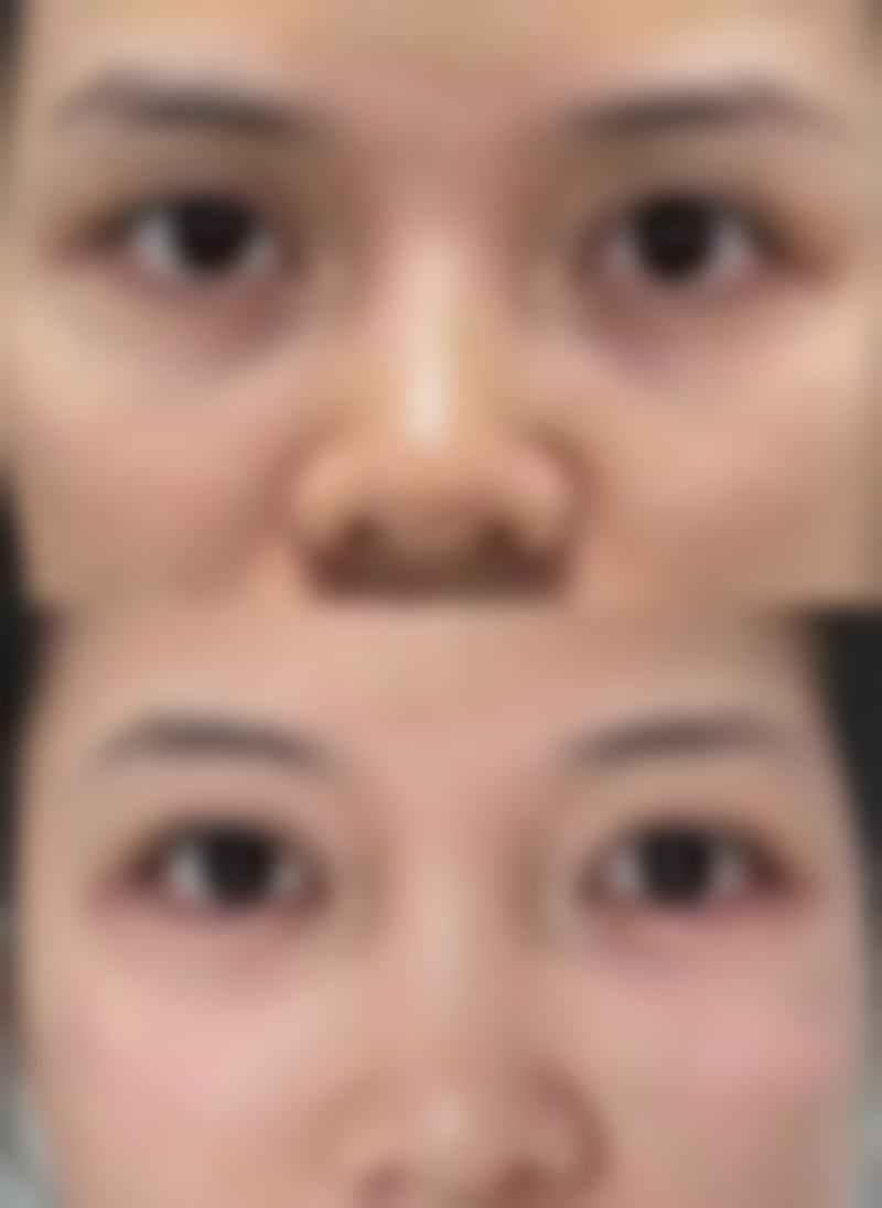 韩国RAUM整形外科医院求美者反馈