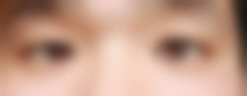 乌鲁木齐博雅整形价格收费