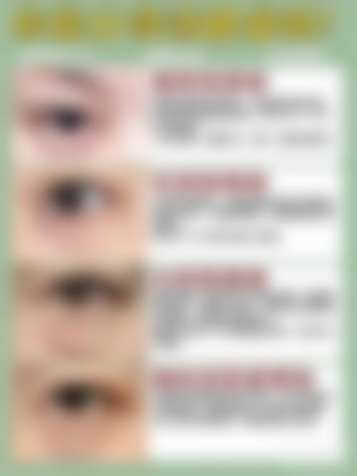 李俊浩医生的成功医美实例