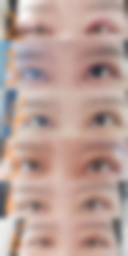 四川人民医院整形美容科怎么样求美者反馈