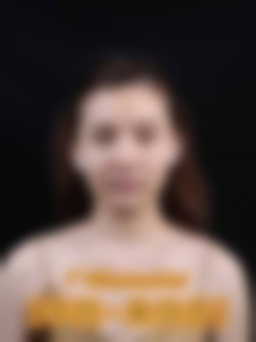 桂林柏琳整形医疗美容求美者反馈