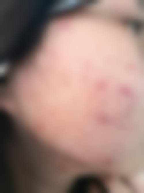 武汉博义整形医院怎么样价格收费