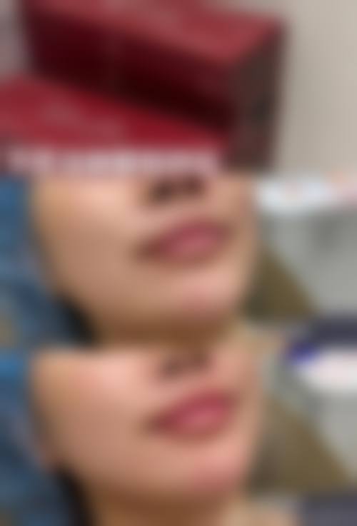 日本东京Prime银座整形医院求美者反馈