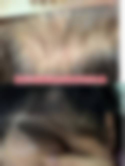 佛山大麦微针植发怎么样来院路线