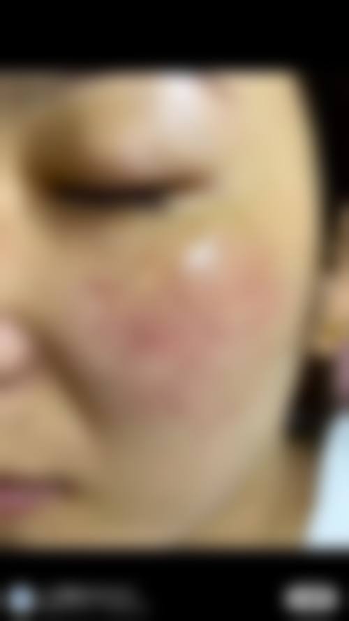 重庆铂菲医疗美容诊所怎么样特色项目及技术优势