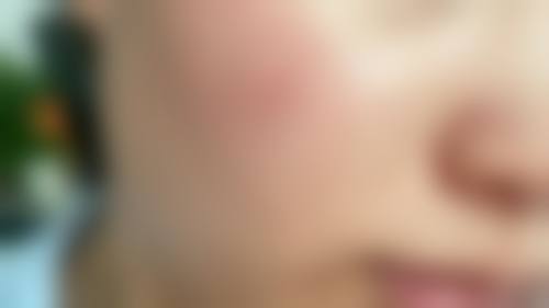 重庆铂菲医疗美容诊所怎么样医生团队实力