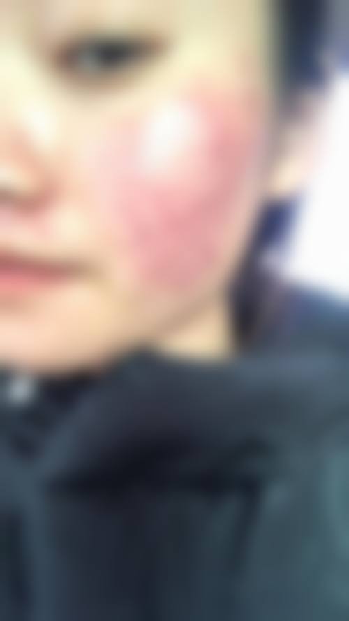 重庆铂菲医疗美容诊所怎么样来院路线