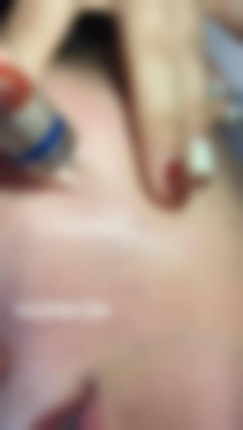 重庆铂菲医疗美容诊所怎么样求美者反馈