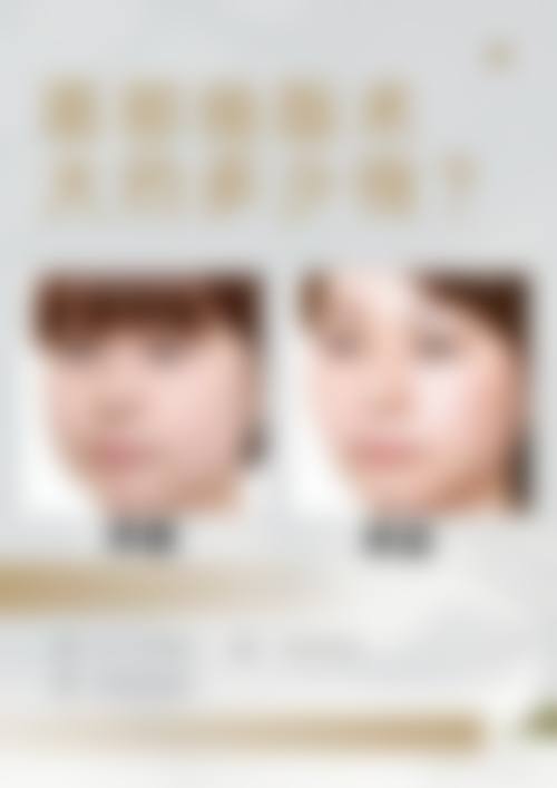 合肥惠更美整形医院怎么样特色项目及技术优势