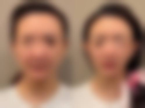 北京华医中医和西医结合皮肤病医院整形科特色项目及技术优势