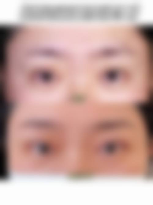 合肥惠更美整形医院怎么样价格收费