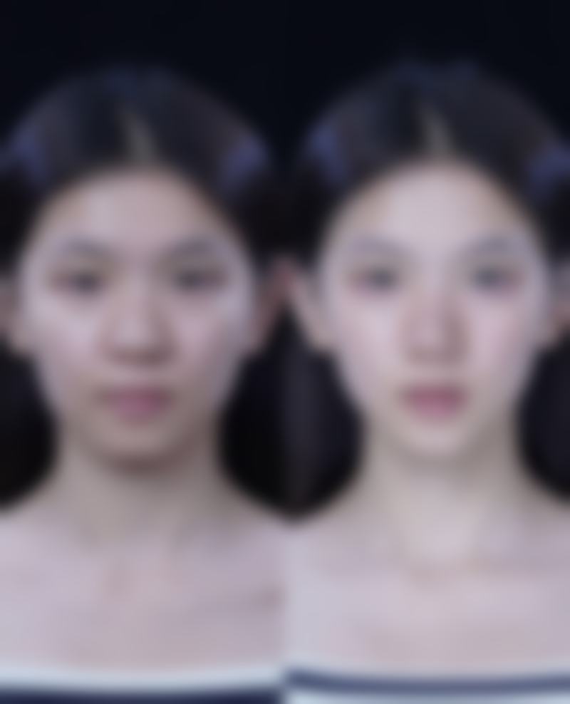 贵阳康馨整形美容医院求美者反馈