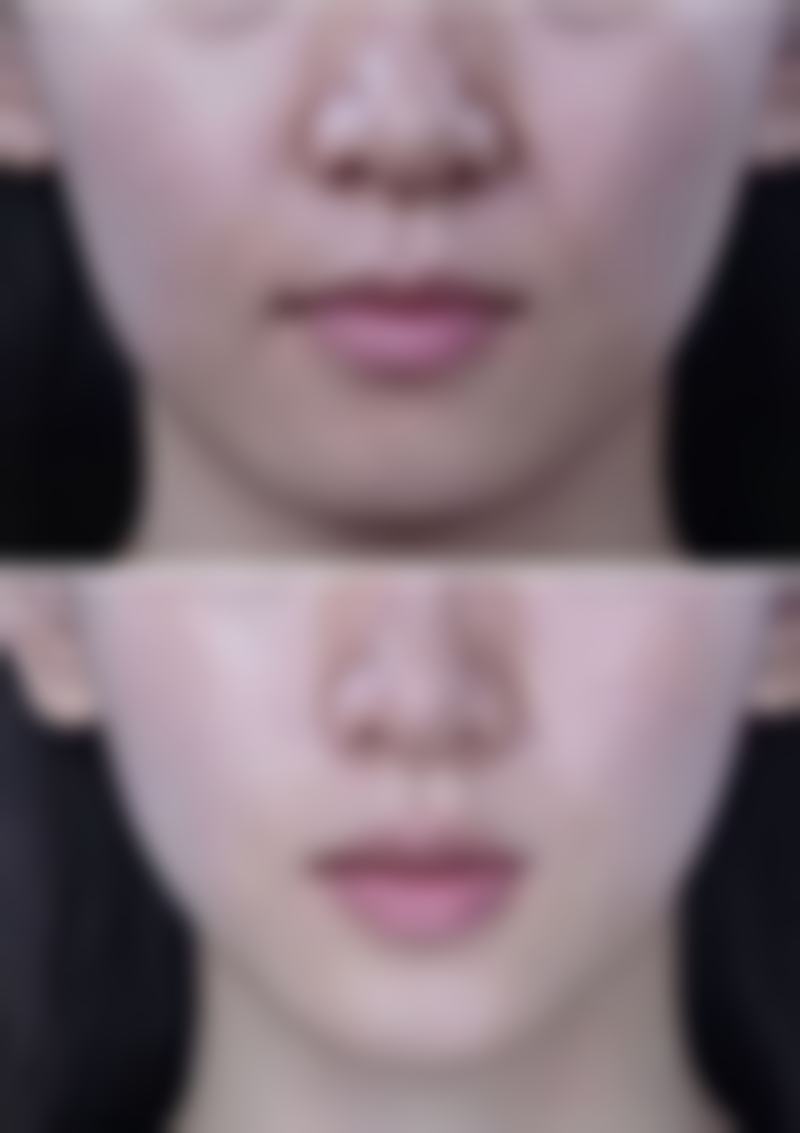 日本东京Prime银座整形医院来院路线