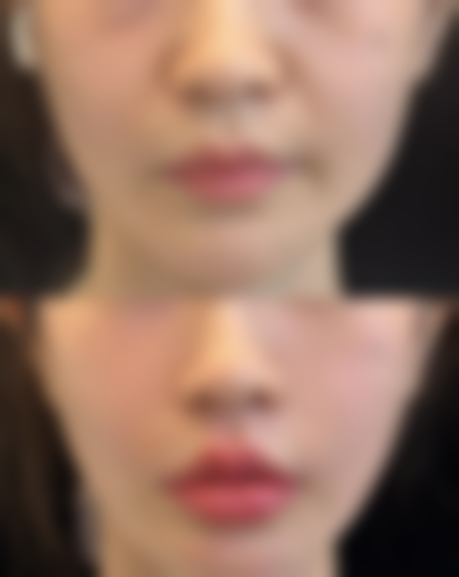 西安艺美医疗美容诊所怎么样来院路线