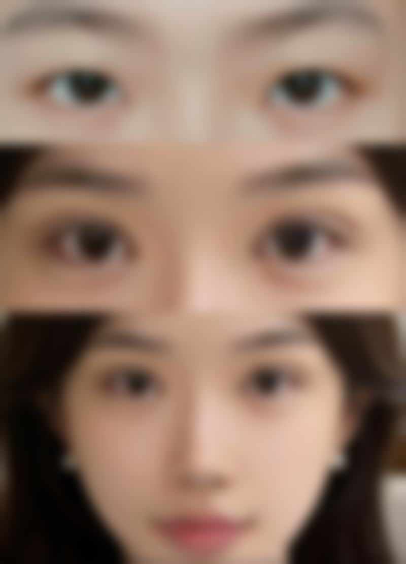 韩国TheOne综合整形医院价格收费